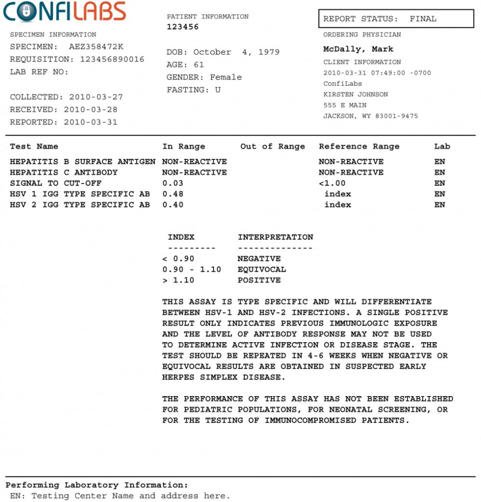 Printable Fake Negative Std Test Results Form